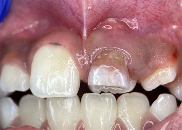 Are double teeth rare?