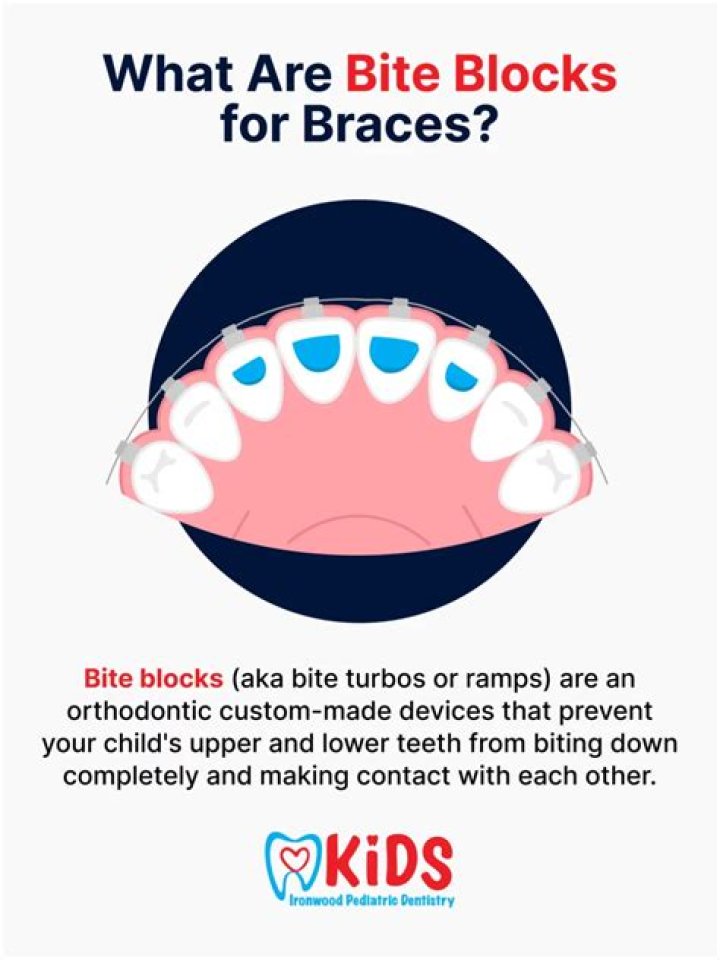 Can bite blocks damage teeth?